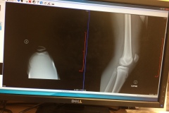 Knee01_01