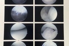 Knee02_04