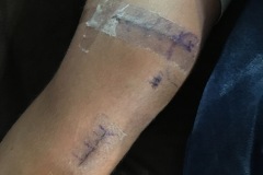 Knee02_10