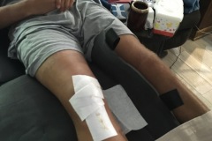 Knee03_05